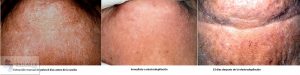 Resultado electrolisis